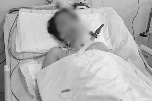 Hạ thân nhiệt cứu sống ngoạn mục người phụ nữ ngưng tim
