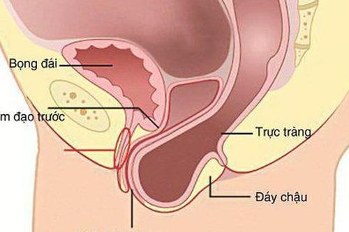 Sa trực tràng dễ nhầm với bệnh gì? Ai hay bị sa trực tràng?