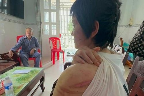 Vụ thai phụ bị chồng bạo hành dã man: Hội LHPN Kiên Giang, Hải Dương vào cuộc