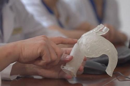 Vinmec áp dụng công nghệ 3D điều trị tim mạch lần đầu tiên ở Đông Nam Á