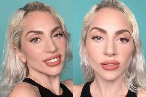 Gương mặt của Lady Gaga gây bàn tán