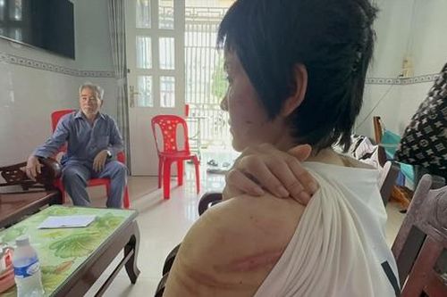 Thai phụ bị chồng bạo hành và cuộc tháo chạy khỏi 'địa ngục'
