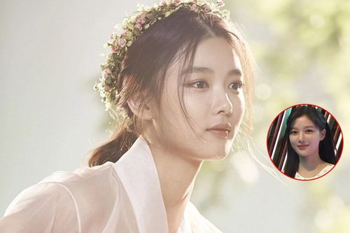 Kim Yoo Jung mất điểm vì làm mũi: Nhan sắc nữ thần khi yêu Park Bo Gum nay còn đâu