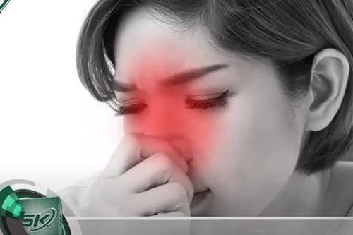 Phòng và trị viêm mũi khi ngồi điều hòa bằng Đông y