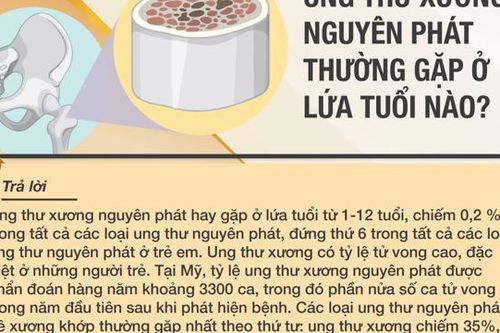 Ung thư xương nguyên phát hay gặp ở lứa tuổi nào?