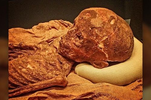Xác ướp tiết lộ trẻ em Ai Cập cổ đại mắc chứng rối loạn máu