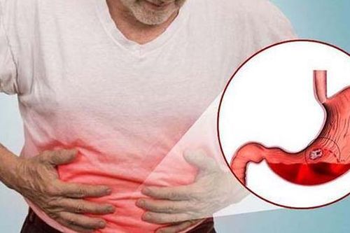 Những thói quen có hại tới dạ dày của bạn