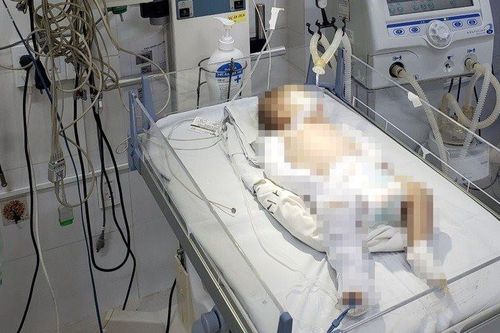 Bé gái 2 tháng tuổi hôn mê sâu, nghi bị bạo hành