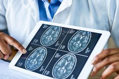 Đột quỵ suýt tử vong vì ong đốt