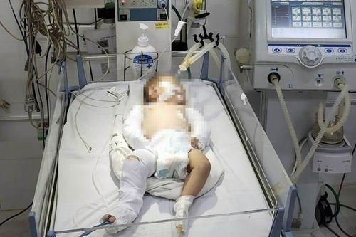 Bắt nhanh nghi phạm bạo hành bé 2 tháng tuổi nhập viện