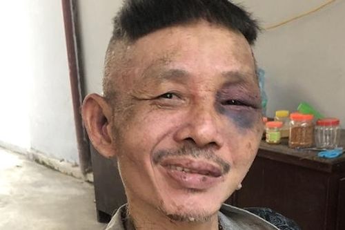 'Ngáo đá' liên tục chửi bới, đe dọa các nhà hàng xóm