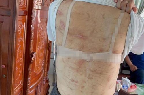 Vụ thai phụ bị chồng bạo hành dã man: Hình phạt nào cho kẻ vũ phu?