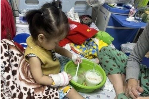 Bé gái khò khè suốt 3 tháng do miếng thịt kẹt trong phế quản