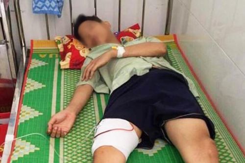 Điều tra vụ hỗn chiến trong đêm tại Quy Nhơn