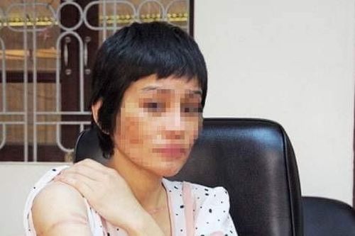 Kẻ vũ phu khai lý do bạo hành vợ đang mang thai như thời trung cổ