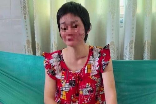 Vấn đề pháp lý trong vụ chồng bị tố bạo hành vợ mang bầu 7 tháng