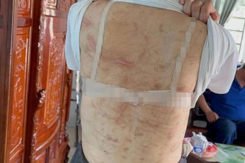 Vụ vợ mang thai 7 tháng bị chồng bạo hành như thời trung cổ: Người chồng có thể bị xử lý thế nào?