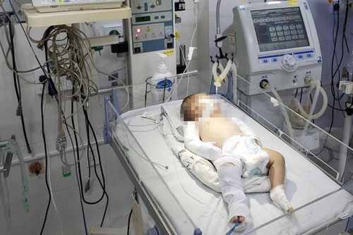Kẻ bạo hành bé 2 tháng tuổi thừa nhận nhiều lần đánh vì cháu quấy khóc