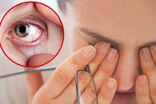 Người bệnh khô mắt có thêm liệu pháp điều trị mới