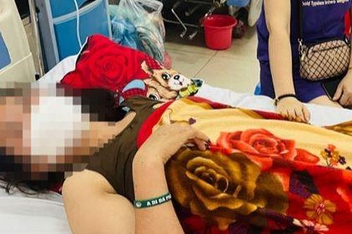 Hy hữu: Người phụ nữ bị thang máy rơi trúng đầu