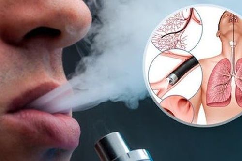 Thứ trưởng Bộ Y tế: Thuốc lá điện tử không phải sản phẩm ít hại, ít nguy cơ đối với sức khỏe