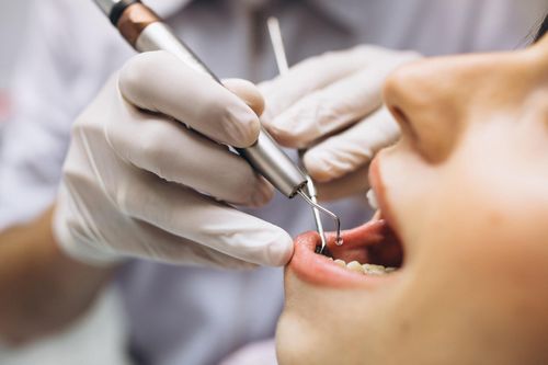 Cô gái 23 tuổi ở Brazil tử vong vì nhiễm trùng sau nhổ răng khôn