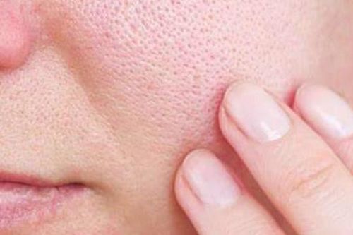 Thói quen hàng ngày khiến lỗ chân lông bị bít tắc