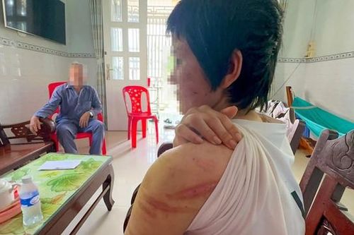 Bắt tạm giam kẻ đánh đập vợ mang bầu 7 tháng suốt thời gian dài