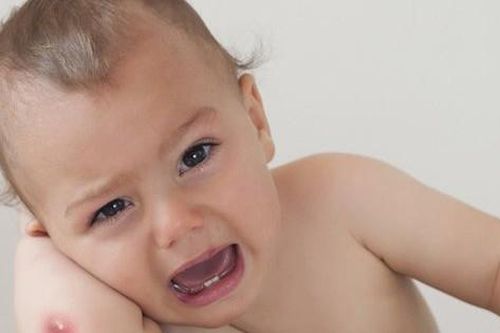 Mùa nóng cảnh giác với nhiễm trùng do nhọt ở trẻ