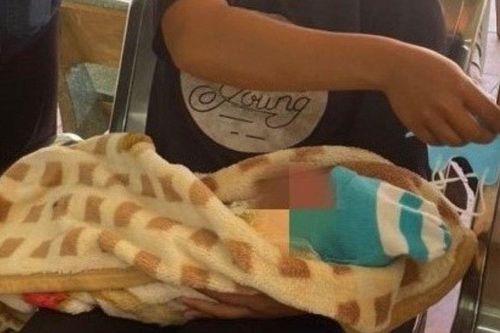 Vừa chào đời bé đã phải nhập viện khâu 21 mũi vì sai lầm của người lớn