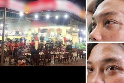 4 nhân viên quán hải sản đánh người rồi khai... nhầm