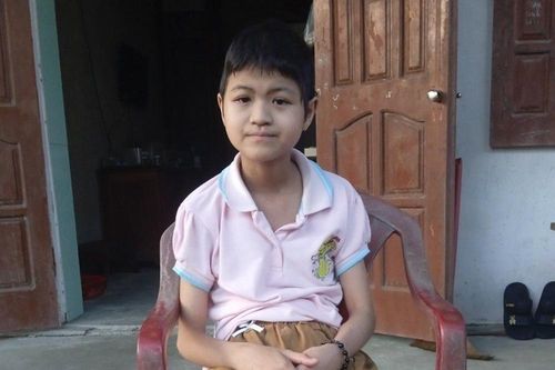 Cô bé mắc ung thư xương có bàn chân xoay ngược
