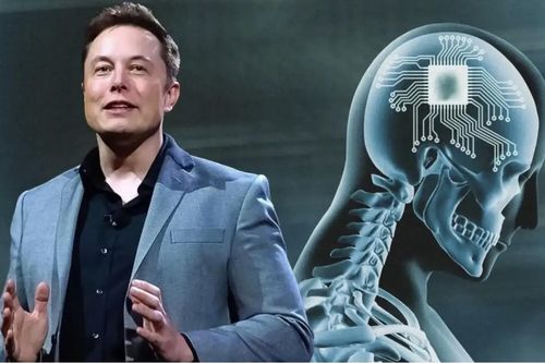 Công ty của Elon Musk được phép thử nghiệm cấy chip vào não người