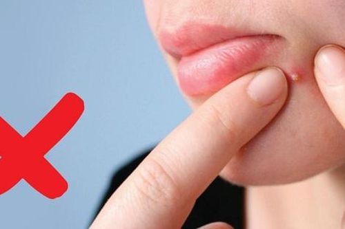 3 biến chứng đáng sợ khi nặn mụn không đúng cách