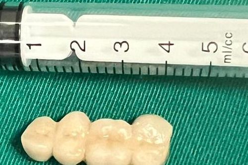 Đỡ cháu trượt ngã, bà bị răng giả chui tọt vào bụng phải đi cấp cứu