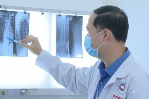 Tổn thương đốt sống, gãy xương sườn sau khi nắn bẻ khớp