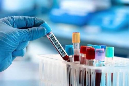 Nhóm máu nào 'cho tất cả, không nhận lại của ai'