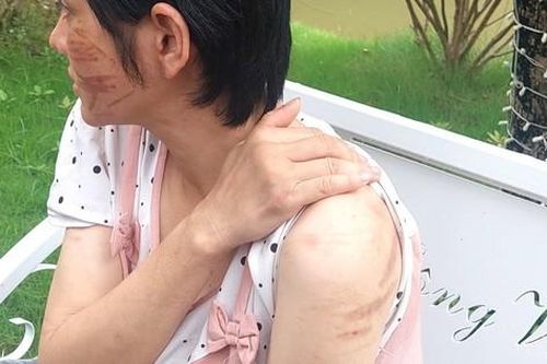 Thông tin mới nhất vụ vợ mang bầu 7 tháng bị chồng bạo hành dã man ở Hải Dương