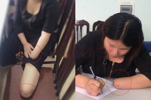 Muôn chiêu trò lừa đảo trục lợi tiền bảo hiểm