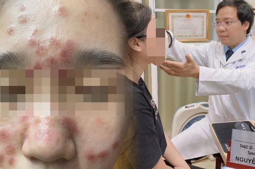 Chi tiền triệu để sở hữu làn da căng bóng, nhận lại khuôn mặt đầy nốt u cục