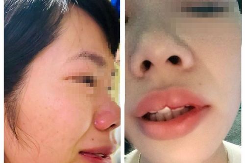 Xử phạt phụ huynh đến nhà đánh cô giáo vì con bị hạnh kiểm trung bình