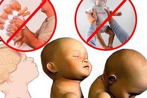 Rung lắc trẻ sơ sinh nguy hiểm thế nào? Những bệnh tiềm ẩn trẻ có thể mắc phải?