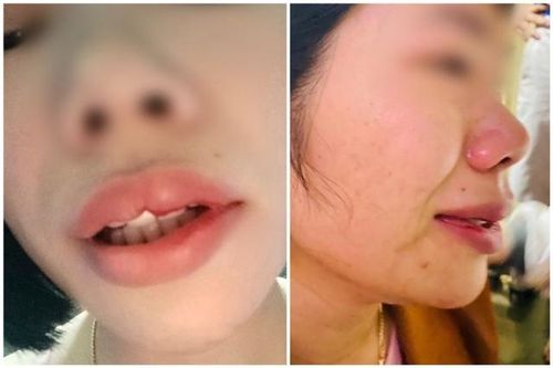 Tin mới nhất vụ thầy giáo hành hung cô giáo của con ở Đắk Nông