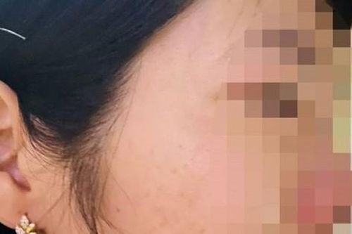 Vụ phụ huynh đánh cô giáo vì con hạnh kiểm trung bình: Xem xét kỷ luật