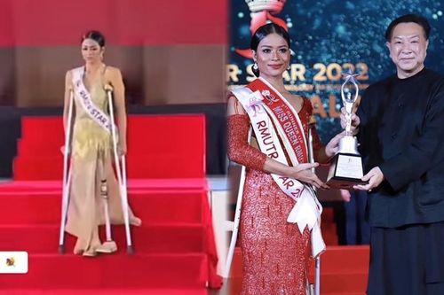 Rộ clip một thí sinh hoa hậu cụt chân trình diễn váy dạ hội, thực hư ra sao?