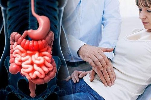 Hội chứng ruột kích thích là gì? Cách điều trị cần biết