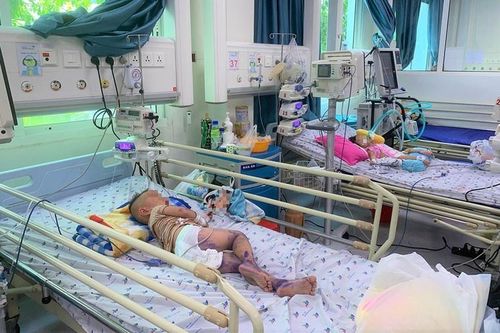 Coi chừng nguy cơ bệnh tay chân miệng lan thành dịch