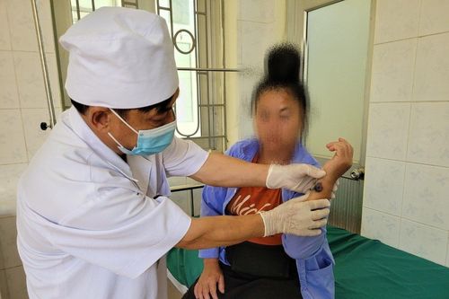 Điện Biên cơ bản khống chế dịch bệnh than trên người