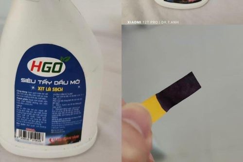 Bé 3 tuổi suýt mù mắt vì chai nước tẩy rửa