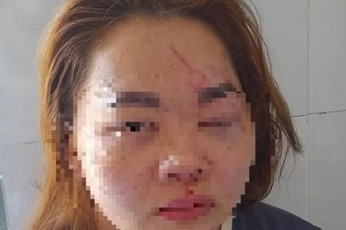 Tin mới vụ thầy giáo ở Đắk Lắk đánh vợ nhập viện cấp cứu
